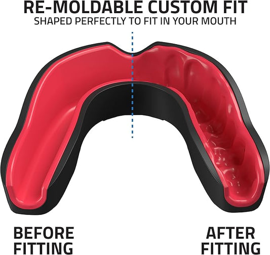 Evo Shield Premium Sports Mouthguard with Case – Comfortable Gum Shield for Jaw Protection in Boxing, MMA, Football, Rugby, Karate & More